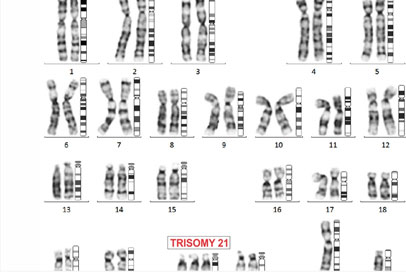 Karyotyping